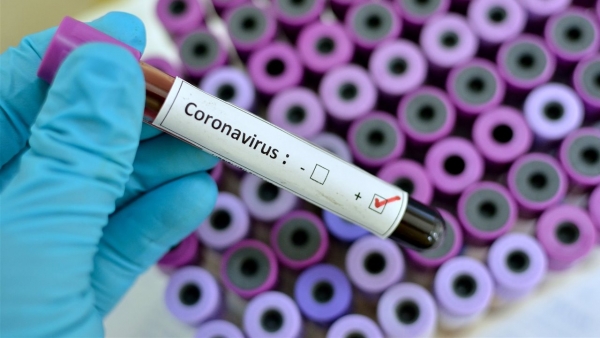 Científicos israelíes podrian obtener una vacuna contra el coronavirus