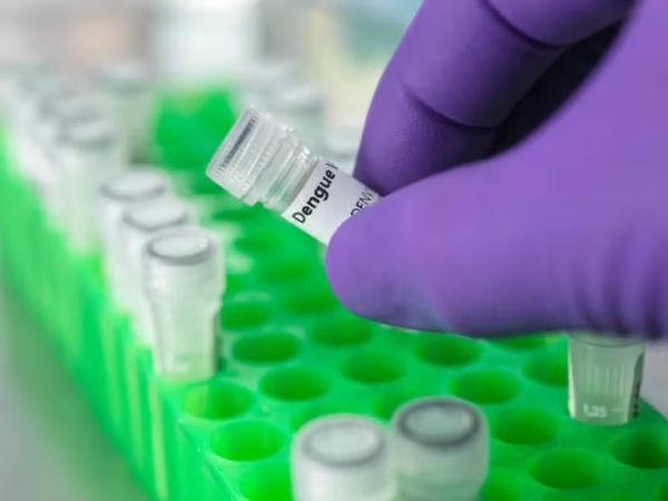 Dengue en la Argentina: cu&aacute;les son los s&iacute;ntomas m&aacute;s frecuentes en los casos graves