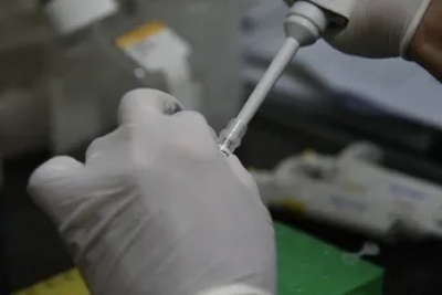 Se confirm&oacute; el primer caso de viruela s&iacute;mica en la provincia