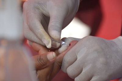 Hemofilia: en Jujuy son 70 los pacientes registrados