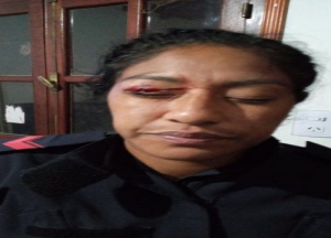 Polic&iacute;as atacados y lesionados en operativo de prevenci&oacute;n en Campo Verde