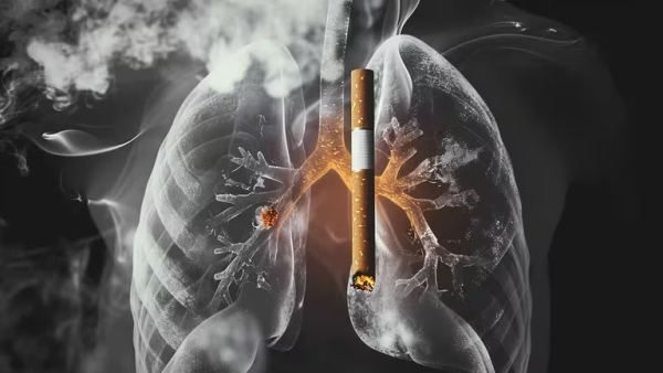 Aprobaron en Argentina un tratamiento contra el c&aacute;ncer m&aacute;s mortal y de mayor prevalencia