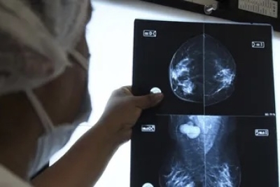 Mamograf&iacute;as a disposici&oacute;n en el Hospital de Humahuaca