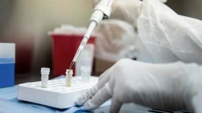 Suman 382 los fallecidos y 8.371 los contagiados por coronavirus en Argentina