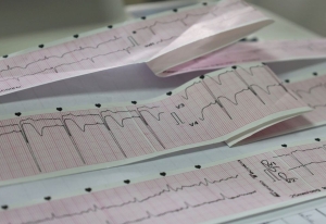 Las enfermedades cardiovasculares se pueden prevenir