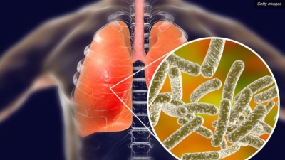 Qu&eacute; es la Legionella, c&oacute;mo se transmite y por qu&eacute; puede provocar enfermedad mortal