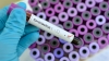 Coronavirus: hay 3 nuevos contagiados y la lista llega a 34