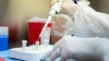 Dos nuevos casos de la variante Delta en viajeros que llegaron del exterior