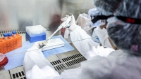 469 personas murieron y 10.625 fueron diagnosticadas con coronavirus en el pa&iacute;s