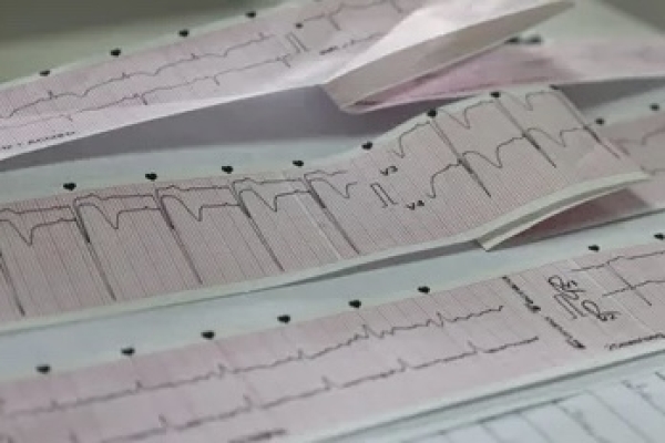 En dos meses, la Red IAM duplic&oacute; la respuesta a personas con infarto