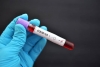 Coronavirus: Jujuy no registr&oacute; casos nuevos positivos y 400 test domiciliarios dieron negativo